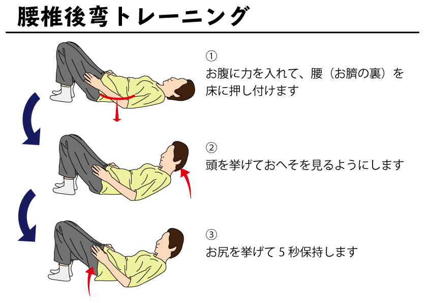 腰椎変性後弯症の治療選択肢